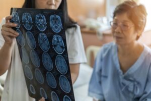 Brain Injury Lawyer In Baltimore